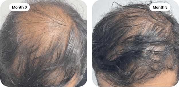 revview img 04-min